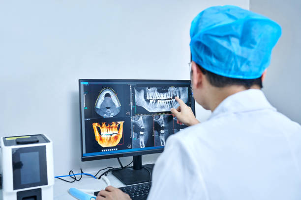 Best Emergency Wisdom Tooth Extraction in West Modesto, CA